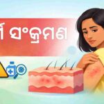 Hello odia Skin Infection Odia health Blog